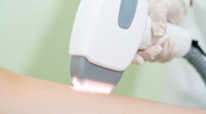 macchinario professionale per depilazione laser in centro estetico