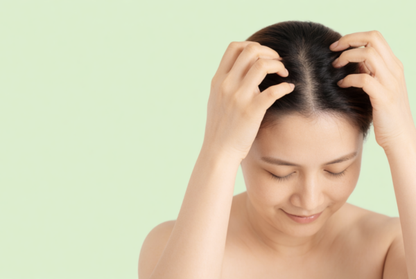 Donna che si massaggia il cuoio capelluto con le dita